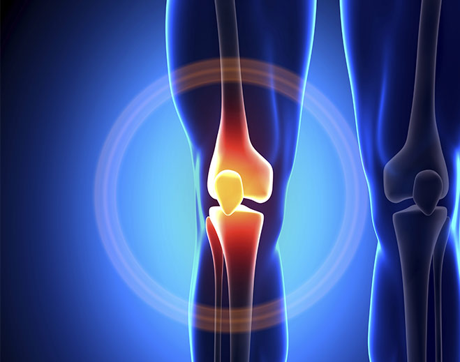 Knee joint pain and orthopedic illustration